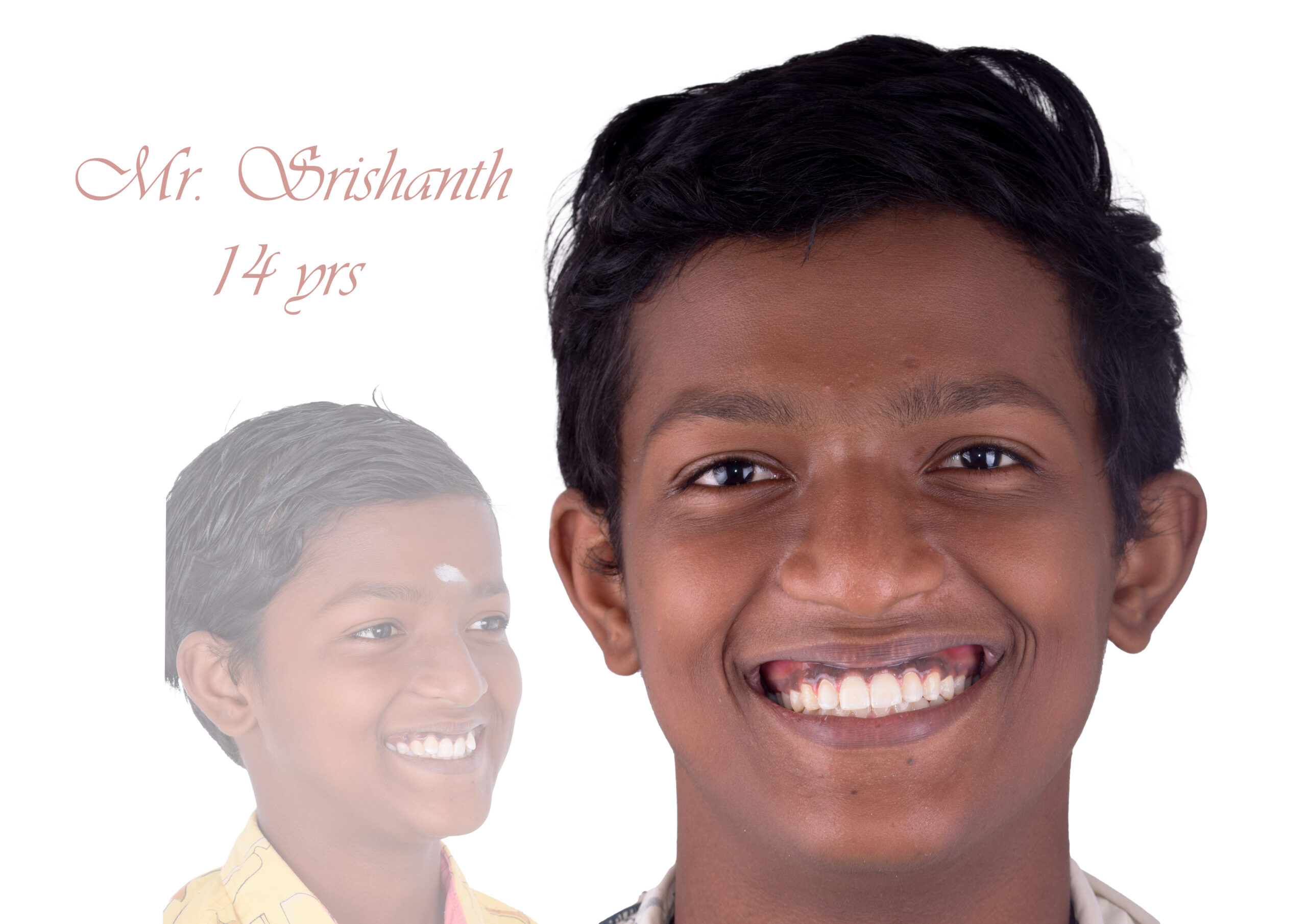 180. srishanth 1