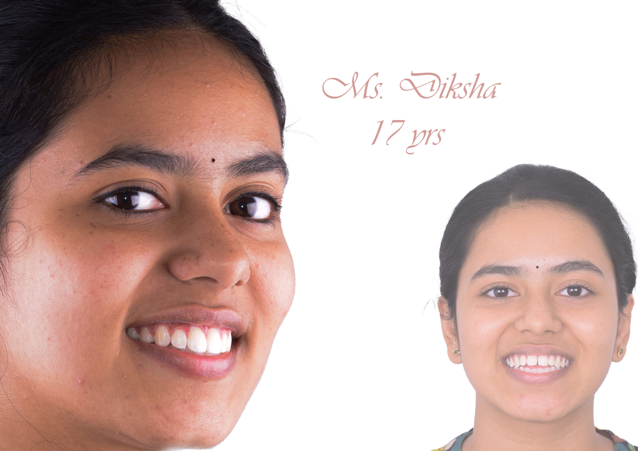 50. DIKSHA 1